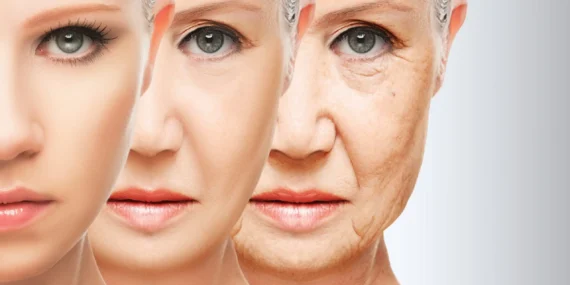 premature-aging syndrome