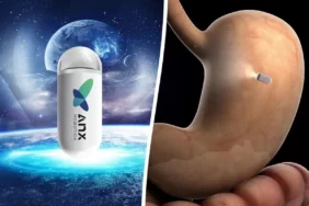 Anx-Robotica-8957347895349534756