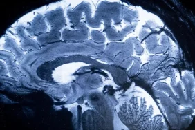 Insan-Beyni-34892348923498234