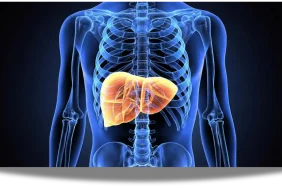 Karaciğer yağlanması vakalarının 2050 yılına kadar 1,8 milyara ulaşması bekleniyor