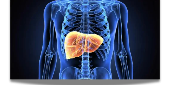 Karaciğer yağlanması vakalarının 2050 yılına kadar 1,8 milyara ulaşması bekleniyor